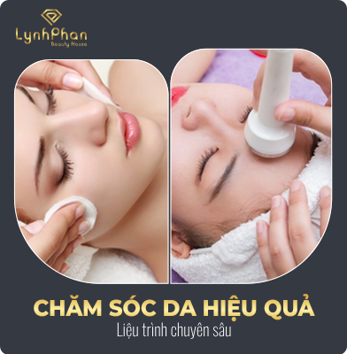 Chăm sóc da hiệu quả 