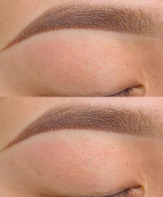 Hút Dung Dịch Mày 