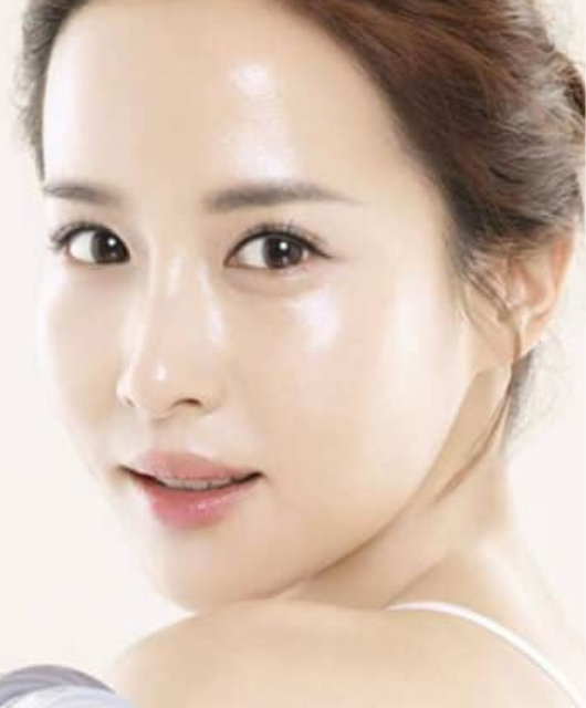 Cấy HA căng bóng, sáng